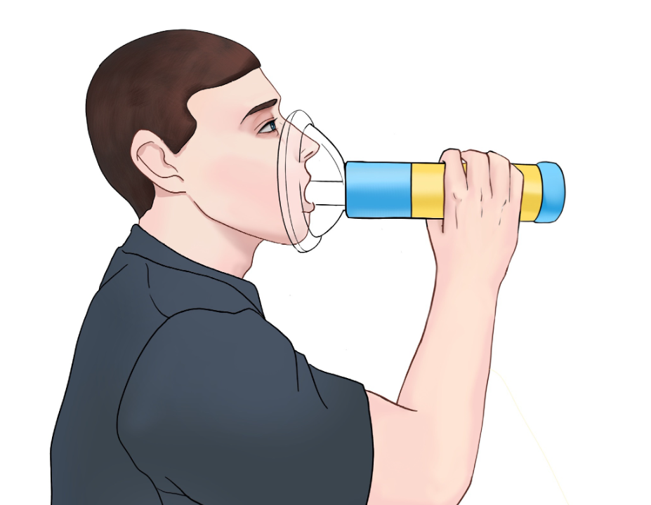 Choking Emergency Device – Child Safety Aid